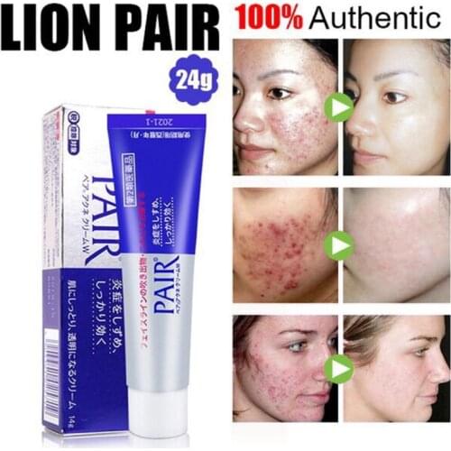 Original Japan Lion Pair Acne Medicated Cream Anti Acne Cream On The Face For Acne Pimple Treatment Skin Care Face Cream 24g