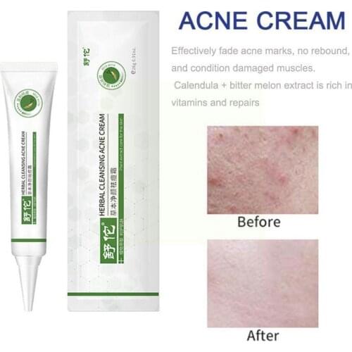 Natural Extraction Acne Cream Anti-Wrinkle Moisturizing Essence Skin Whitening No Cream Peptide Stimulate Care Moisturzing J8C7