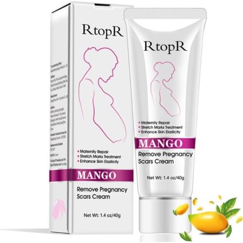 40g Mommy Stretch Marks Repair Remove Pregnancy Scar Cream Acne Fat Striae Gravidarum Treatment Smooth Skin Recover