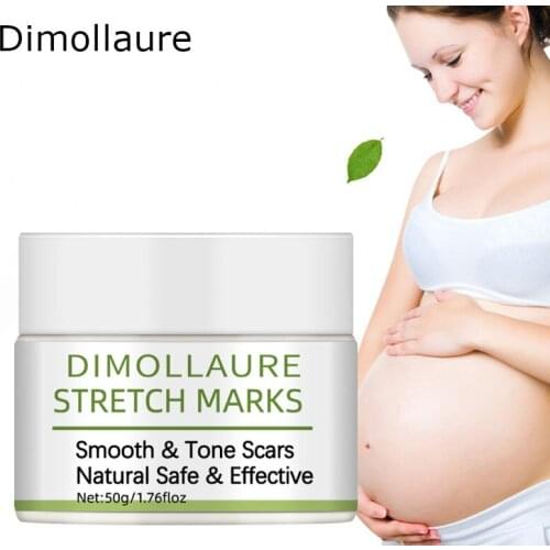 Dimollaure Stretch Marks Remover Cream Skin Care Treatment Cream For Removal Pregnancy Scars Maternity Slackline Body Cream