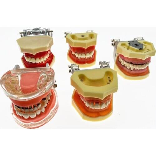Dental Teeth Model Simulation Model Study Adult Pathological Periodontal disease for Oral Teeth model
