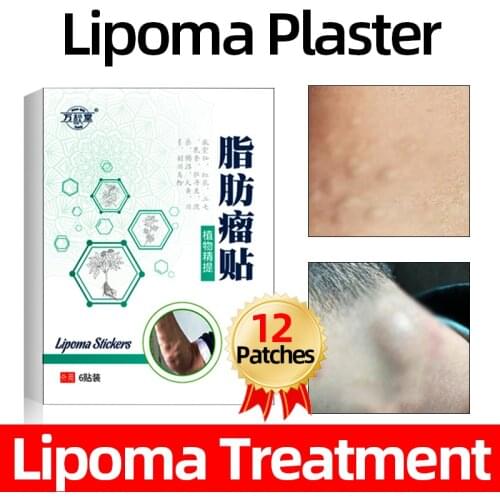 6patches / box Fat Mass Lipoma Remove Patch Multiple Anti-Tumor Peeling Cream Body Hard Block Anti-Sticking Nemesis
