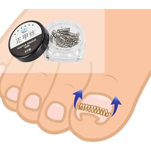 12pcs Ingrown Toe Nail Correction Wire Fixer Pedicure Paronychia Recover Toenails Corrector Foot Care Tool D40