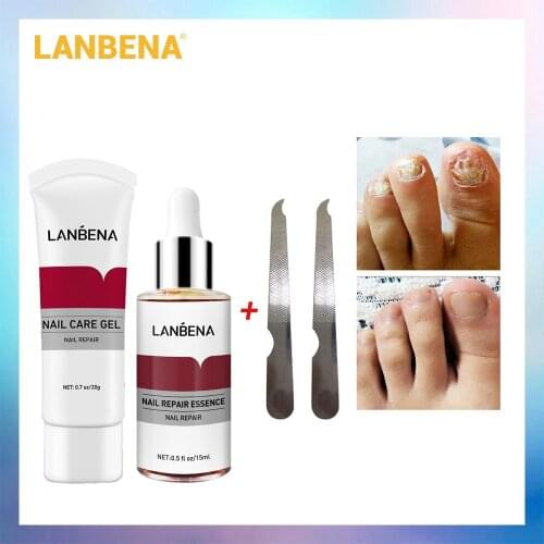 LANBENA Nail Care Gel+Nail Repair Serum Nail Treatment Remove Onychomycosis Nail Hand Foot Care