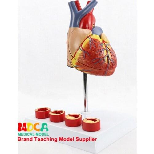 Human 1:1 Natural Grand Deluxe Cardiac Belt 4-stage Vascular Anatomy Model Cardiovascular Medicine Teaching MXZ002