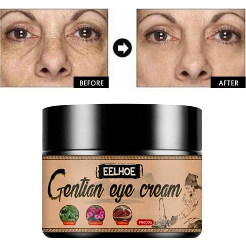 Natural Eye Cream Remove Dark Circle Bags Under The Eyes Prevent And Improve Fat Particles Improve Eye Skin Appearance TSLM1