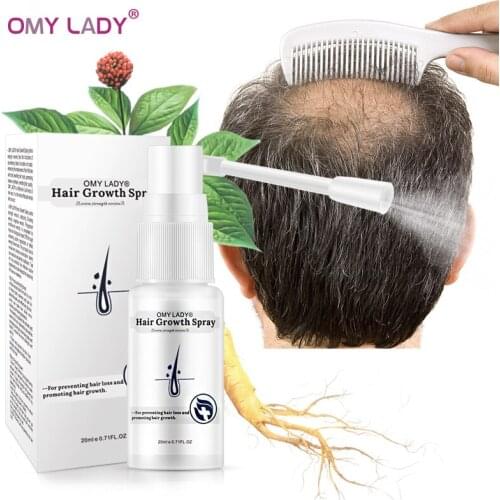 OMY LADY Anti Hair Loss Hair Growth Spray Essential Oil Liquid For Men Women Dry Hair Regeneration Repair Hair Loss Product 20ml