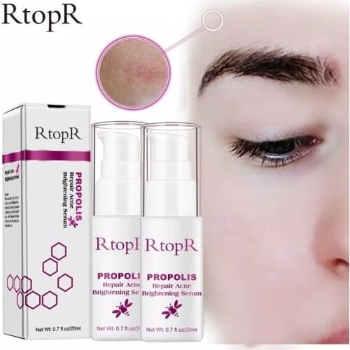 RtopR Propolis Repair Acne Brightening Serum Acne Scar Spots Cleaning Serum Shrink Pores Eliminates Treatment Oil control TSLM1