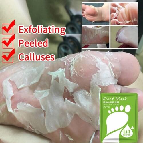 1 Pair Of Exfoliating Exfoliating Foot Masks For Babys Soft Feet To Remove Calluses And Dead Skin Foot Mask Remove Dead TXTB1