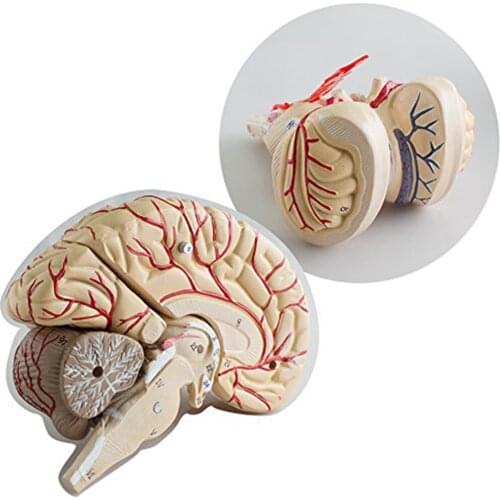 Model, Medical Anatomical Model - 9 Parts, Removable, 135×125×160mm