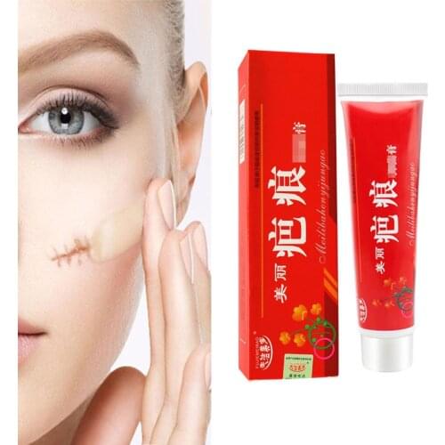 Scar Acne Removal Cream Pimples Stretch Marks Face Gel Remove Acne Smoothing Whitening Moisturizing Body Skin Care 60g