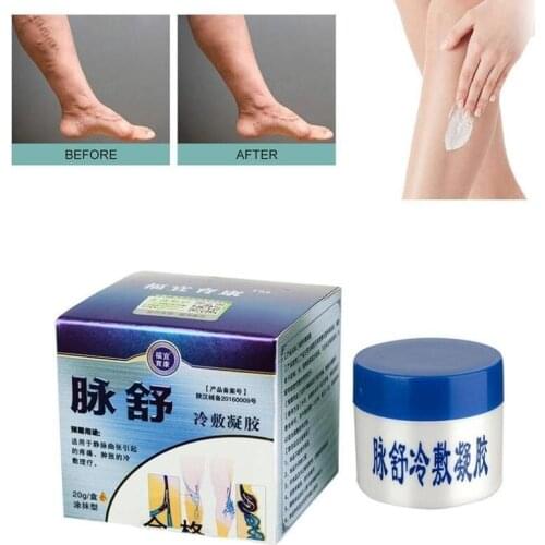 Varicose Vein Ointment Aricose Vasculitis Phlebitis Spider Legs Veins Pain Massage Cream Treat Varicose Vein Ointment Chiness
