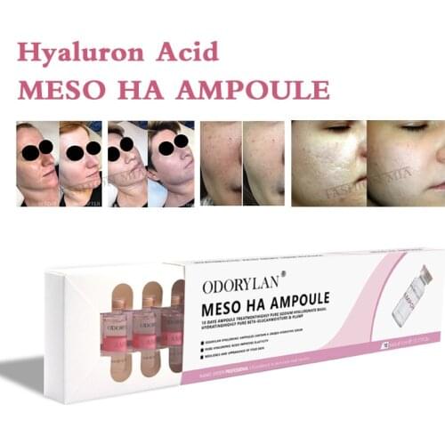 5ml Cross-linked HA Hyaluronic Acid Ampoule Pure Micro Molecular Mesotherapy HA Collagen Hyaluronic Acid Skin Whitening Serum