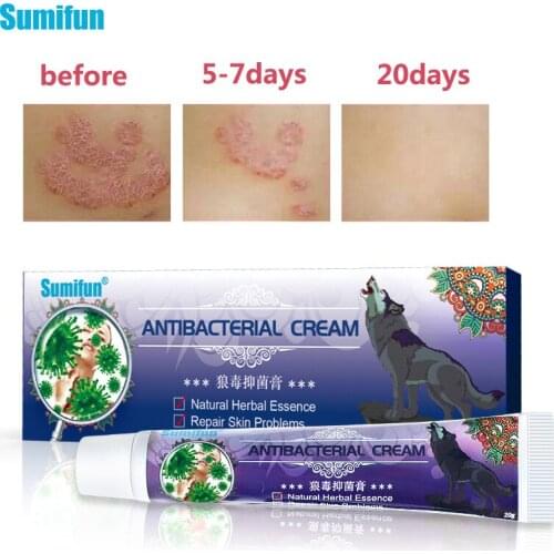 Sumifun Antibacterial Cream Skin Psoriasis Antipruritic Ointment Dermatitis Eczematoid Inhibit Bacteria Itch Item Care K10007