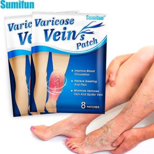 16pcs Sumifun Varicose Veins Plaster Vasculitis Phlebitis Spider Leg Chinese Medical Patch Angiitis Removal Patch Health Care