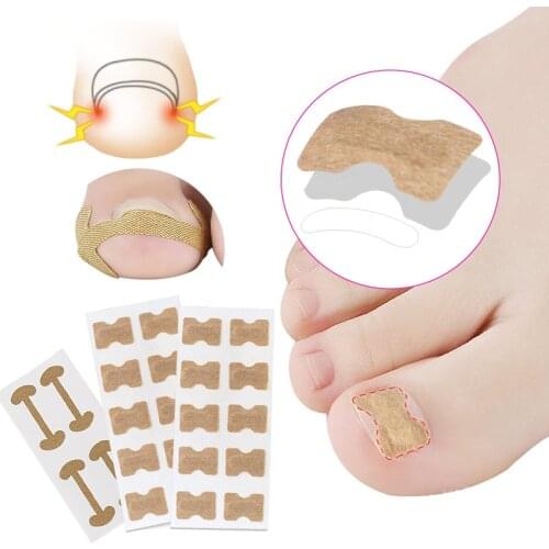 Ingrown Toe Nail Correction Patch Paronychia Corrector Sticker Pedicure Orthodontic Toe Thumb Patch Stickers Pain Relief Toenail