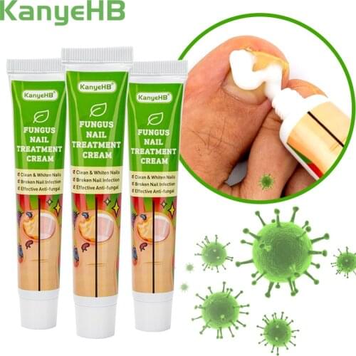3pcs Nail Fungus Treatment Cream Removal Paronychia Onychomycosis Fungal Nail Anti Infection Feet Toe Fungal Nail Care Ointment
