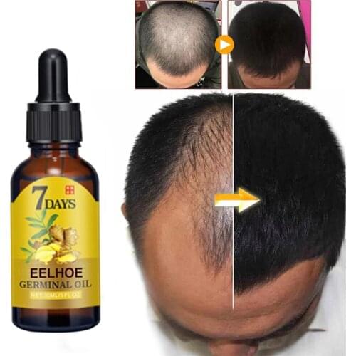 FGHGF Hair Shampoos