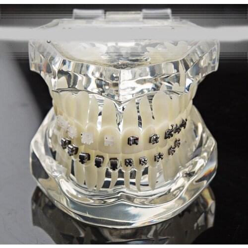 Dental Orthodontic model self-ligating bracket straight wire edgewise bracket four kinds ceramic brackets comparison model