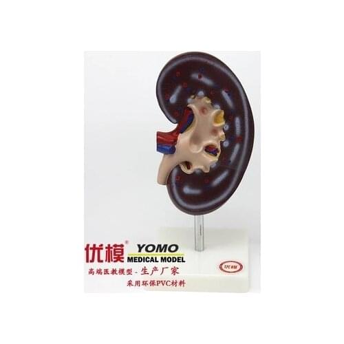 Medical teaching demonstration visual props Human organs Kidney anatomical enlargement model 2X 20*10*7cm