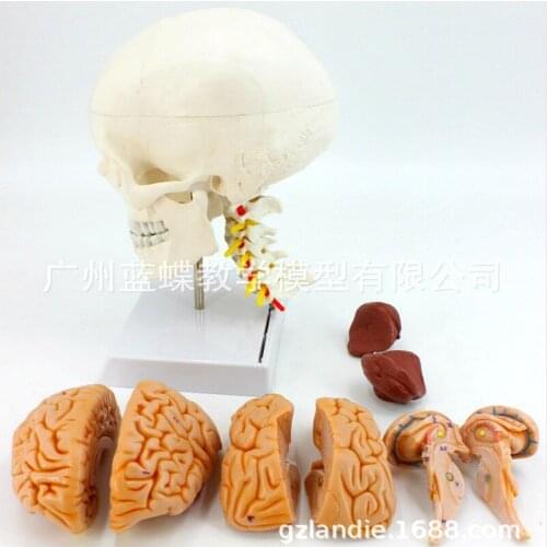 1:1 Cranial model natural size skull belt cervical vertebra attached brain model cranial cerebral artery model with stent