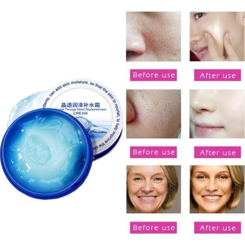 Anti-scar Cream Moisturizing Brighten Firming Essence Anti Wrinkle Anti Aging Day Cream Nature Acne treatment Soften skin Care