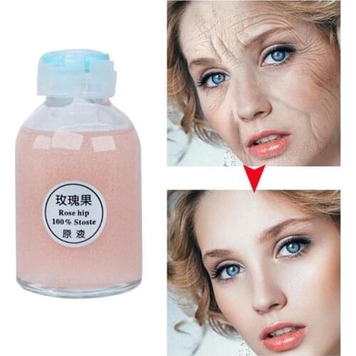 Whitening Serum Strong Hand Feet Lightening Whitening Cleasing Serum To Clean Up Dark Knuckles Serum