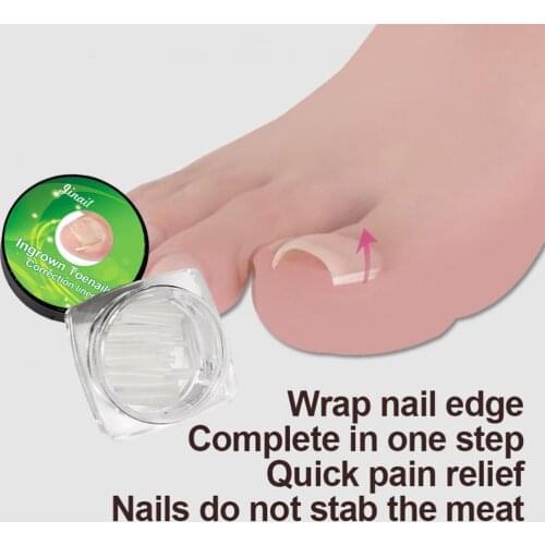 10Pcs/Box Nail Groove-Pad C-Shaped Slot Isolate Toenails Soft Ultra Thin Plastic Toenail Filling Patch for Unisex