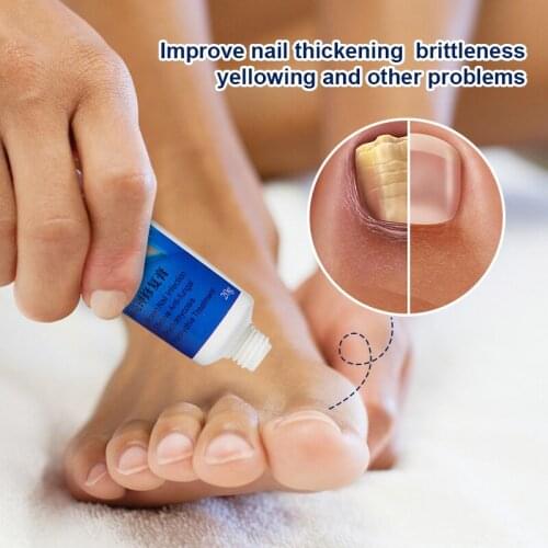 Nail Repairing Cream Promotes Nail Growth Stops Peeling Splitting Improve Thickening Brittleness Yellowing Nails Creams A7