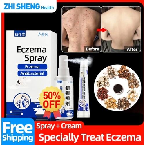 Eczema Herbal Spray Medical Treatment Psoriasis Skin Rash Dermatitis Pruritus Anti-itch Wolf Poison Antibacterial Liquid