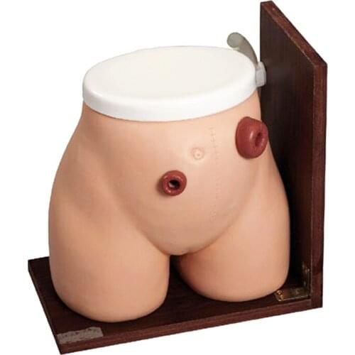Fistulostomy Care Training Colostomy and Ileostomy Nursing Practice Model