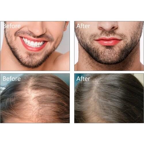 Natural Organic 10ml Castor Oil Hair Essence for Eyelashes Growth,Hair Regrow Hair Growth Essence