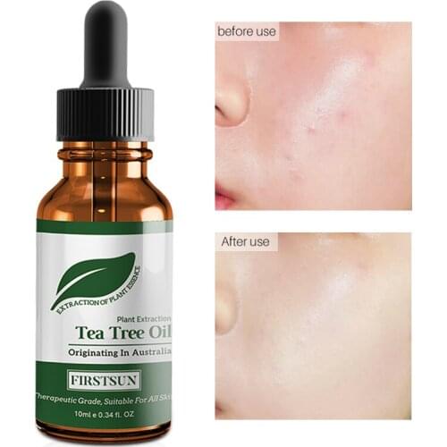 Firstsun Tea Tree Essential Oil Anti-Acne Treatment Oil Control Facial Serum Whitening Darkness Shrink Pores Anti Aging Essence