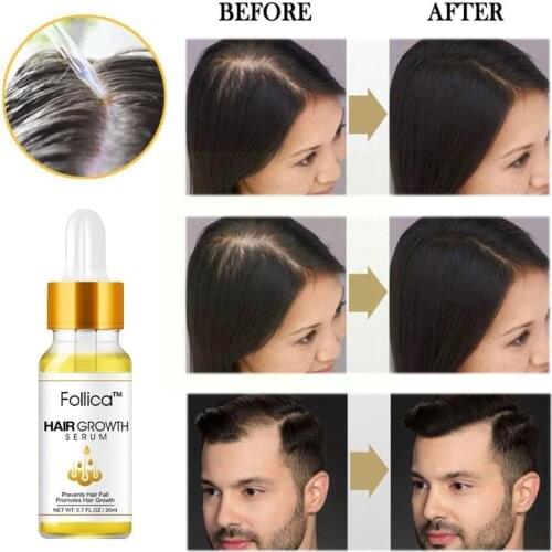 20 Ml Hair Growth Serum Plant Extract Conditioner Anti-ginger Solution Conditioner Hair Hair Growth Growing Shampoo Moistur N1G5