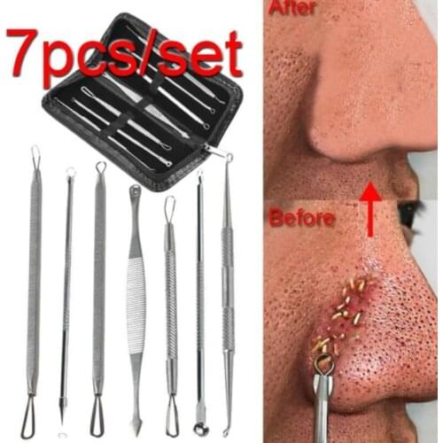 3-8Pcs Blackhead Acne Pimple Remover Needle Stainless Steel Popper Extractor Kit Tools Pore Deep Cleansing Women Beauty Cosmetic