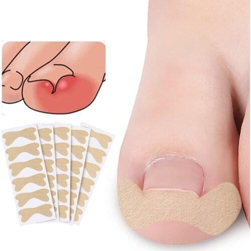 Pedicure Ingrown Nail Tools Toenail Stickers for Nails Corrector Paronychia Treatment Fixer Recover Bunion Pedicura Feet Care
