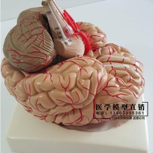 Human brain model Cerebrovascular model 9 parts Brain anatomy model Medical teaching model