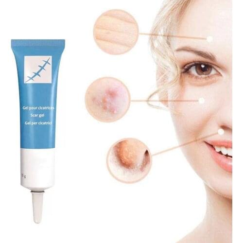 Skin Care Acne Scar Removal Cream Skin Repair ointment Face Spots Treatment Remover Cream Acne Acne Marks Cream Stretch Y3J0