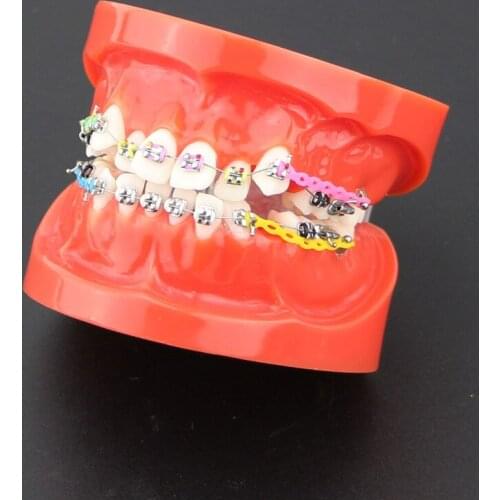 Orthodontic Model 28 Unit Teeth With Half Metal Bracket And Half Ceramic For School Training Study And Communicate With Patients