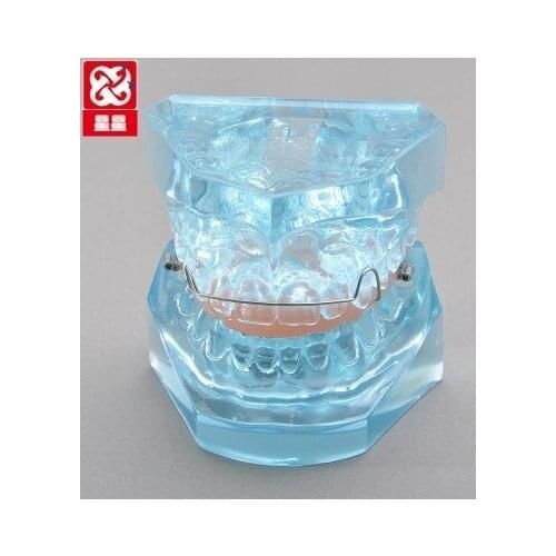 Functional Appliances model Dentistry teaching Patient communication model free shipping
