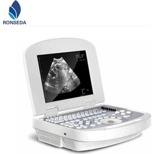 10.7 inches color LCD Laptop Ultrasound Scanner with High-resolution image, elegant appearance
