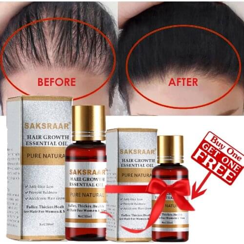 Original100% SAKSRAAR Hair Care Hair Growth Essential Oils Essence Hair Loss Liquid Health Care Beauty Dense Hair Growth Serum