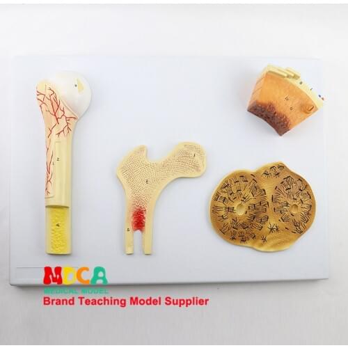 Bone structure model bone cancellous compact bone Haversian periosteal cartilage medical teaching MGT001