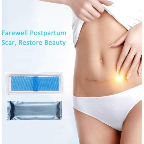 Silicone Scar Removal Patch Remove Trauma Burn Scar Sheet Skin Repair Scar Removal Therapy Patch for Acne Scar Treatment