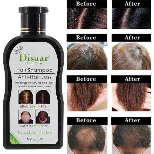 Professional Hair Growth Shampoo Preventing Hair Loss Chinese Hair Regrowth Product Hair Treatment for Men Women Black Hair Dye