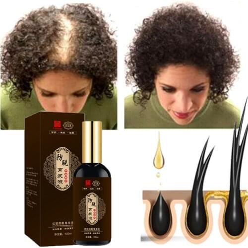 GUANJING Hair Loss Remedies