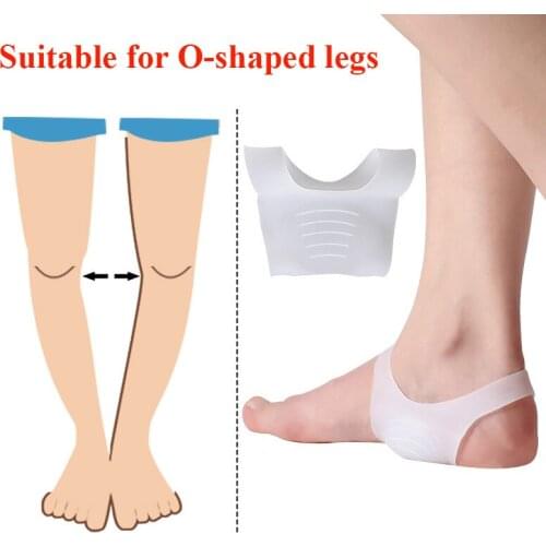 2pcs O-type Foot Corrector Insoles Pads No Slip Shoes For Men And Women Silicone Orthopedic Insoles Foot Care Tool
