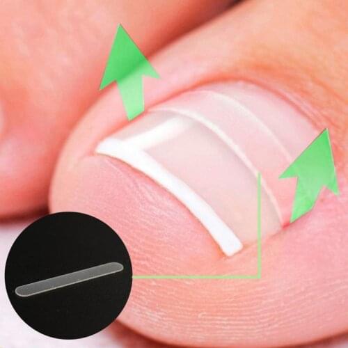 10 PCS/Set Toenail Correction Sticker Ingrown Straightening Curved Brace Elastic Patch Sticker Manicure Pedicure Nail Care Tools