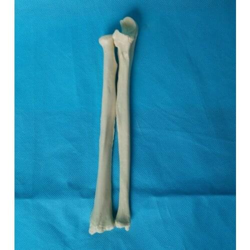 1 Pair Left and Right Human 1:1 Radius Model Medical Teaching Model Radius Cortical Bone Humans Skeleton Model Medical Specimen