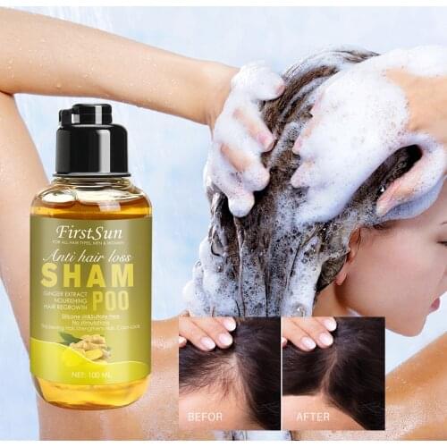 100ml Ginger Shampoo Hair Loss Shampoo Solid Hair Care Anti-Hair Loss Anti-Dandruff Shampoo Hair Growth Treatment